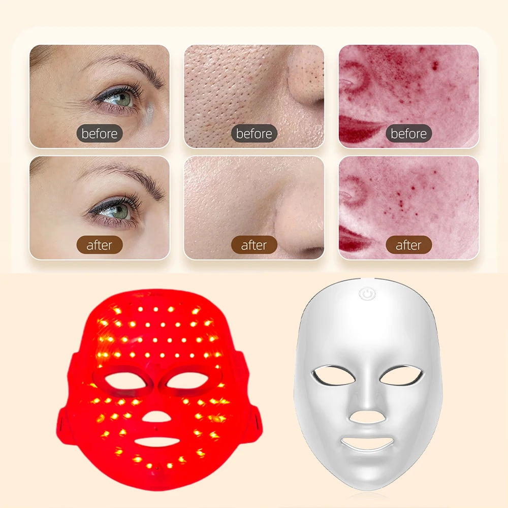 Wireless 7-Color LED Face Mask – Light Therapy for Anti-Aging & Acne