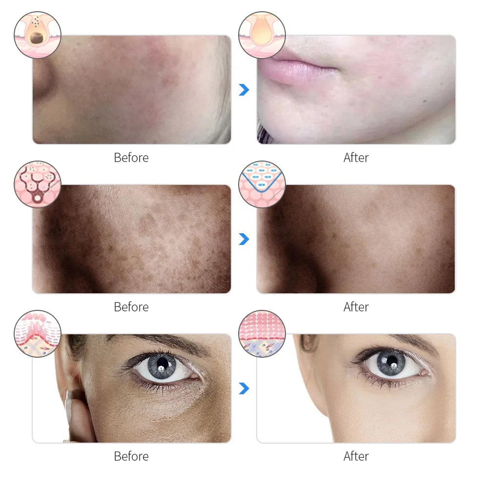 Rechargeable LED Face Mask – 7-Color Light Therapy for Skin Rejuvenation